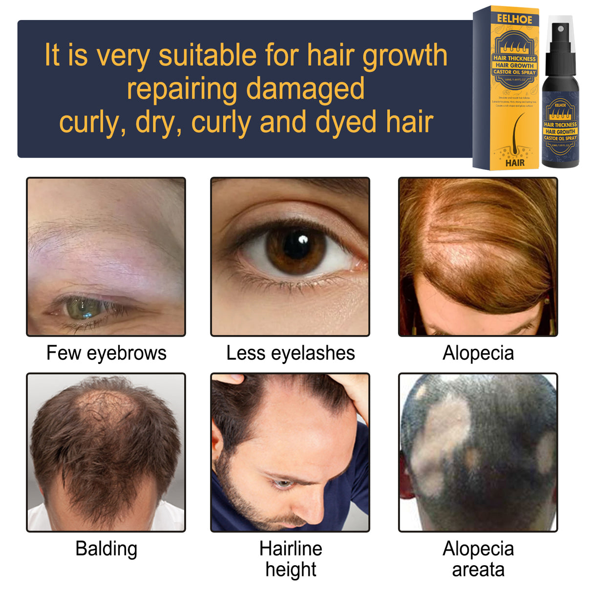 Dense Castor Oil Nutrient Solution, Hair Prevention, Moisturizing Hair Follicles Massage Repair Hair Hair - V.I.P Digital Presence