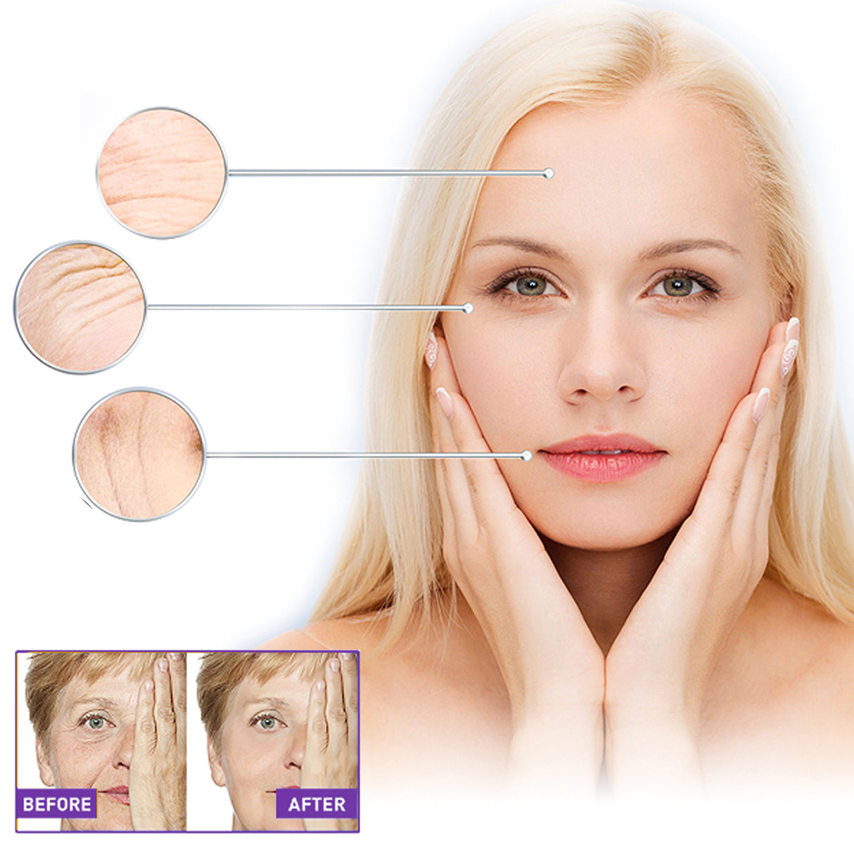 Facial Wrinkle Patch, Droop Decree Line Lift Facial Skin Tightens Mouth Line Cheek Patch - V.I.P Digital Presence