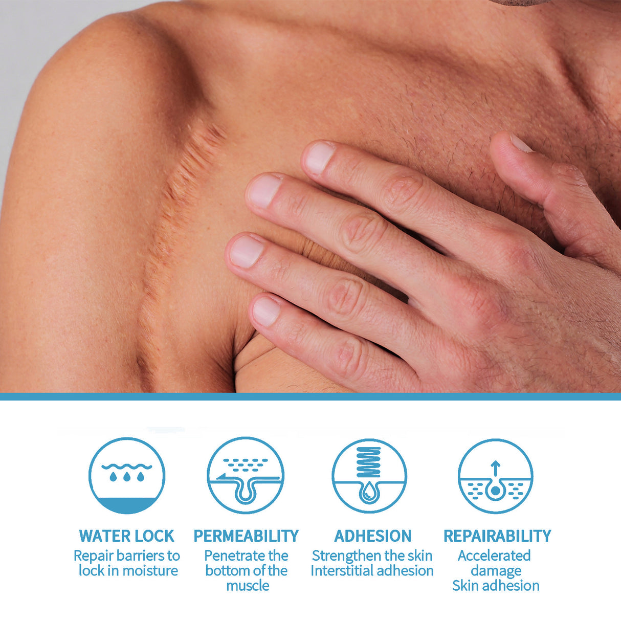 Scar Repair Serum Lightens Post-Pregnancy Scar Repair And Smoothes Body Skin - V.I.P Digital Presence