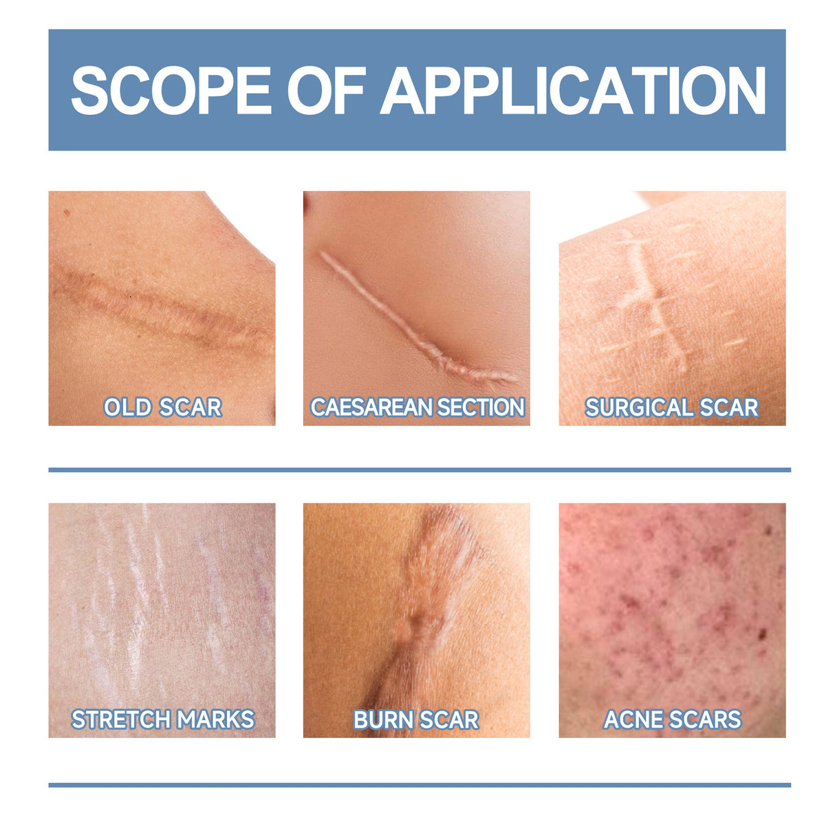 Oceaura Scar Whitening Repair Gel Moisturizes And Smooths Skin Repair Surgery Scar Pregnancy Care Gel - V.I.P Digital Presence