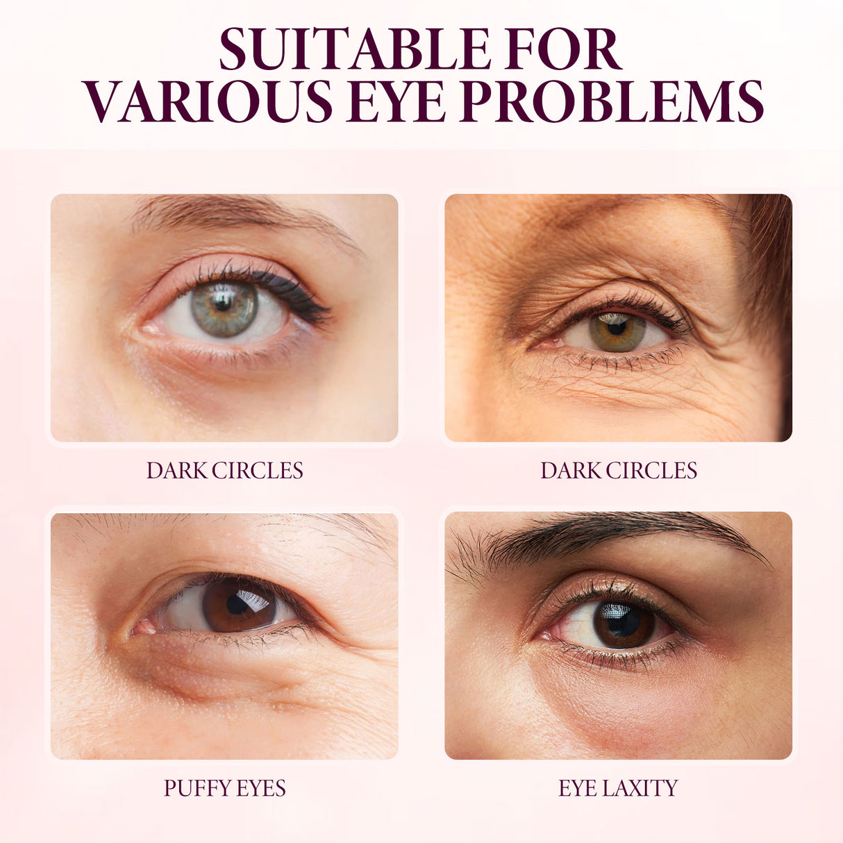 Mango Eye Cream Reduces Fine Lines Of Crow's Feet Bags And Gently Nourishes Elasticity And Tightens The Skin Around Eyes - V.I.P Digital Presence