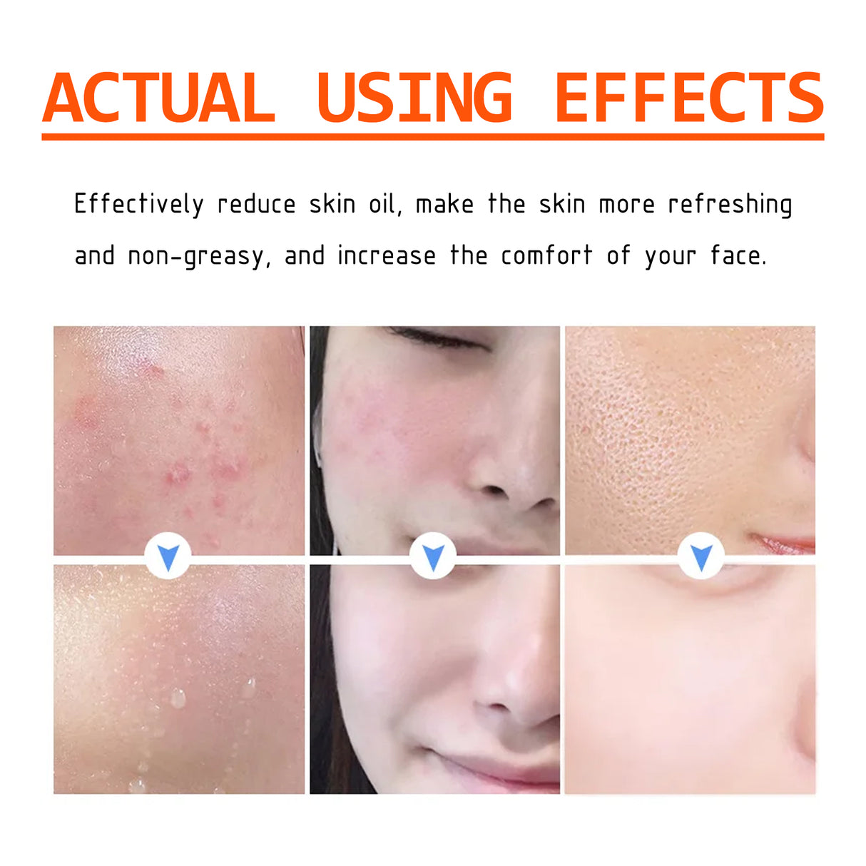 Salicylic Acid Facial Mask Gentle Cleansing Mask To Lighten Acne, Seal And Tighten Pores - V.I.P Digital Presence