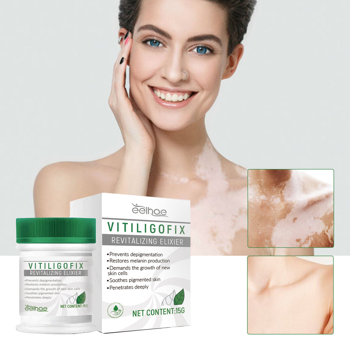 White Spot Repair Cream Skin White Spot Melanin Repair Even Skin Tone Topical Care Cream - V.I.P Digital Presence