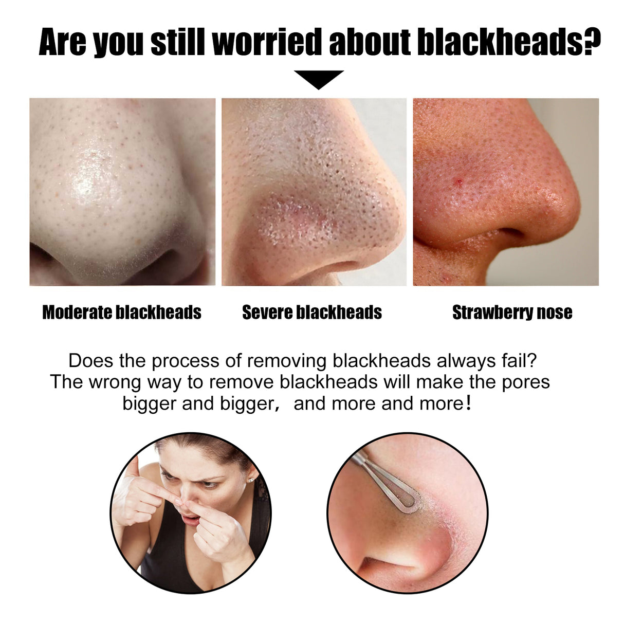 Black Pig Nose Patch, Bamboo Charcoal Remove Blackhead Acne Tear Nose Mask Patch - V.I.P Digital Presence