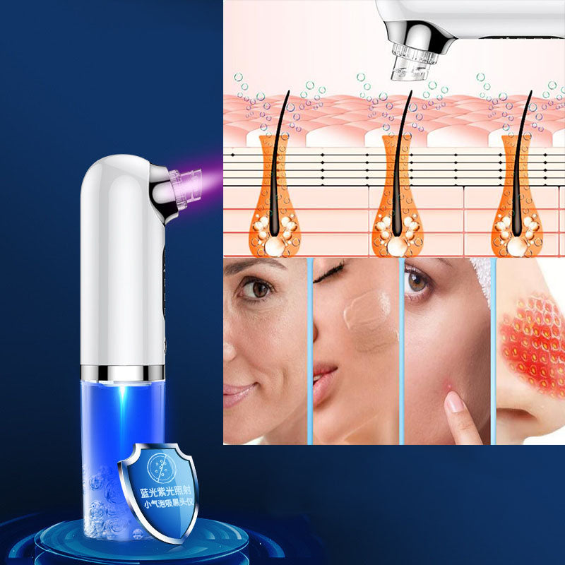 Small Bubble Beauty Instrument Household Pore Cleaning Oxygen Injection Instrument Electric Blackhead Suction Instrument - V.I.P Digital Presence