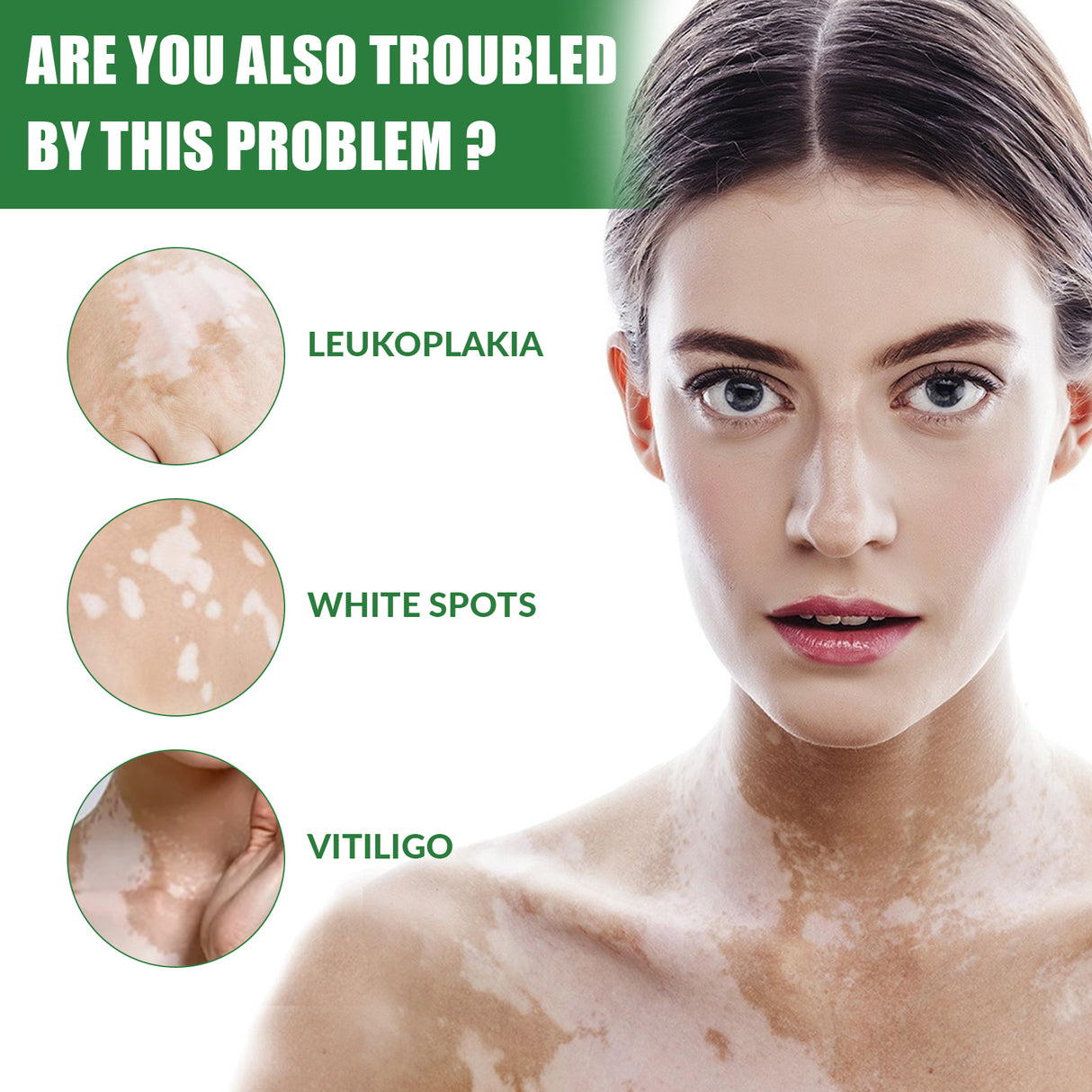 White Spot Repair Cream Skin White Spot Melanin Repair Even Skin Tone Topical Care Cream - V.I.P Digital Presence