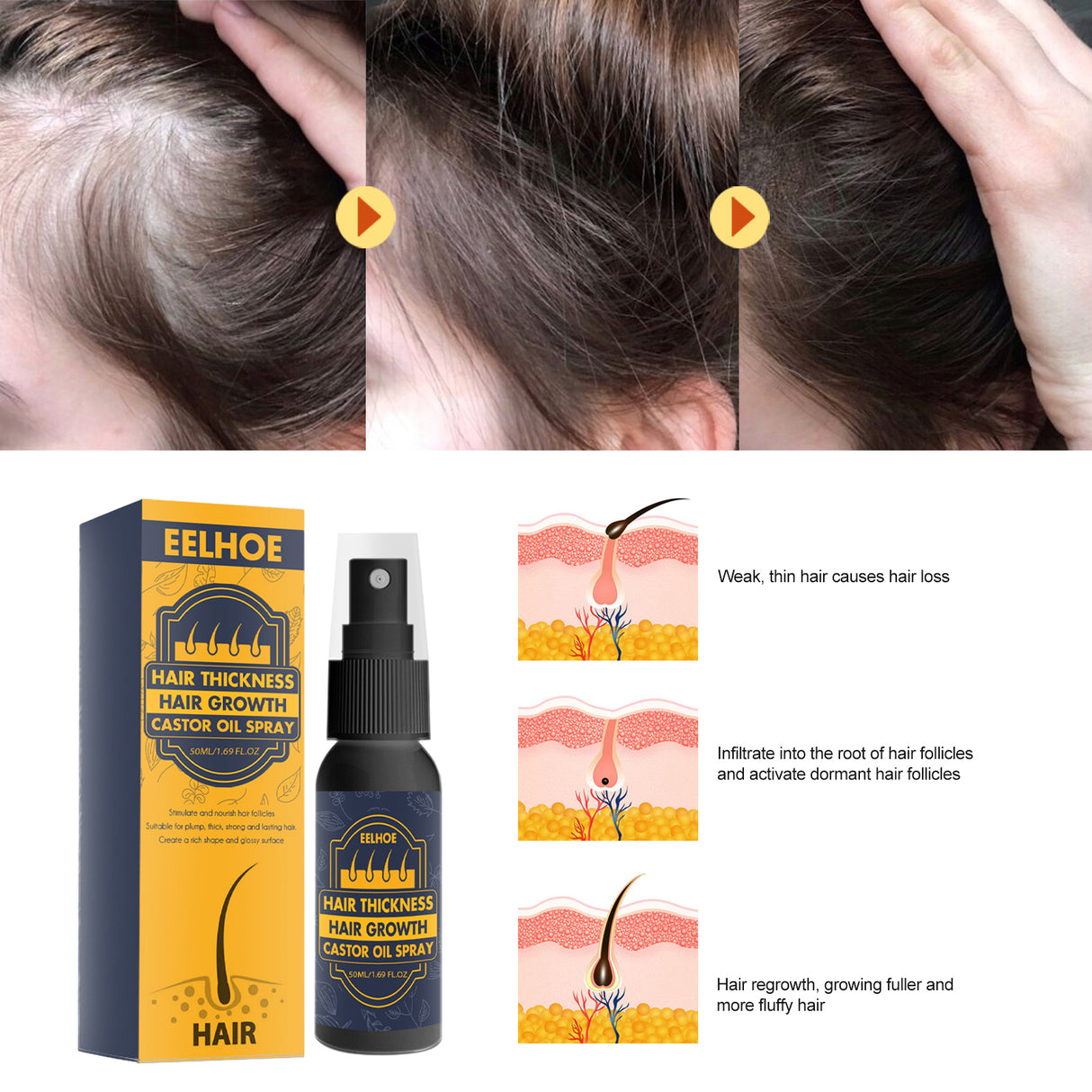 Dense Castor Oil Nutrient Solution, Hair Prevention, Moisturizing Hair Follicles Massage Repair Hair Hair - V.I.P Digital Presence