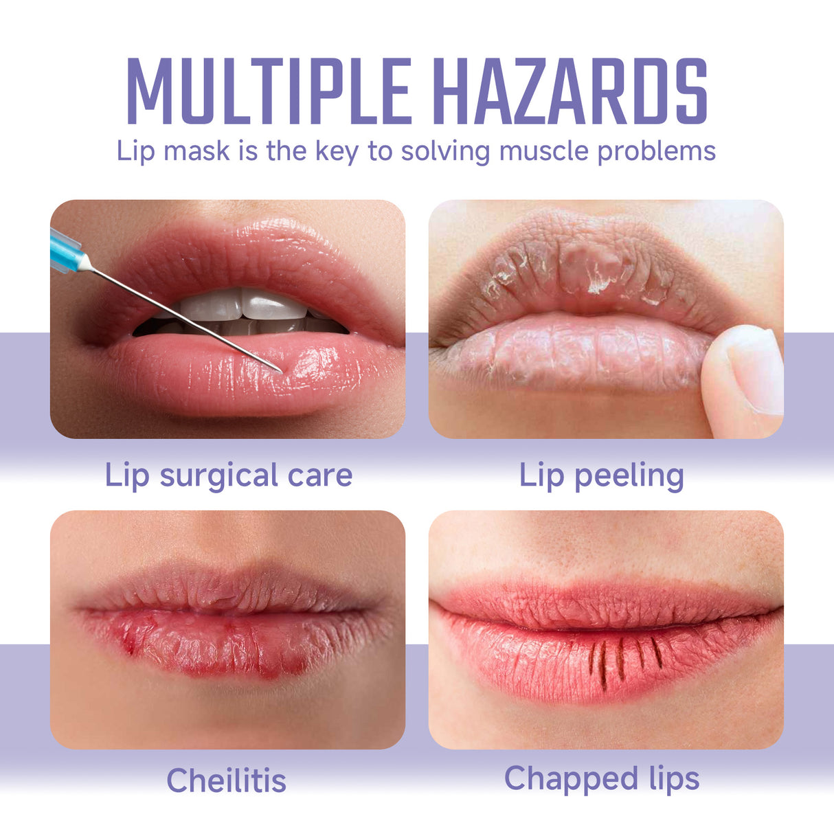 Ouhoe Collagen Lip Mask Repair Lip Lines, Remove Dead Skin, Prevent Dry And Crack, Moisturize And Care Lip Mask - V.I.P Digital Presence