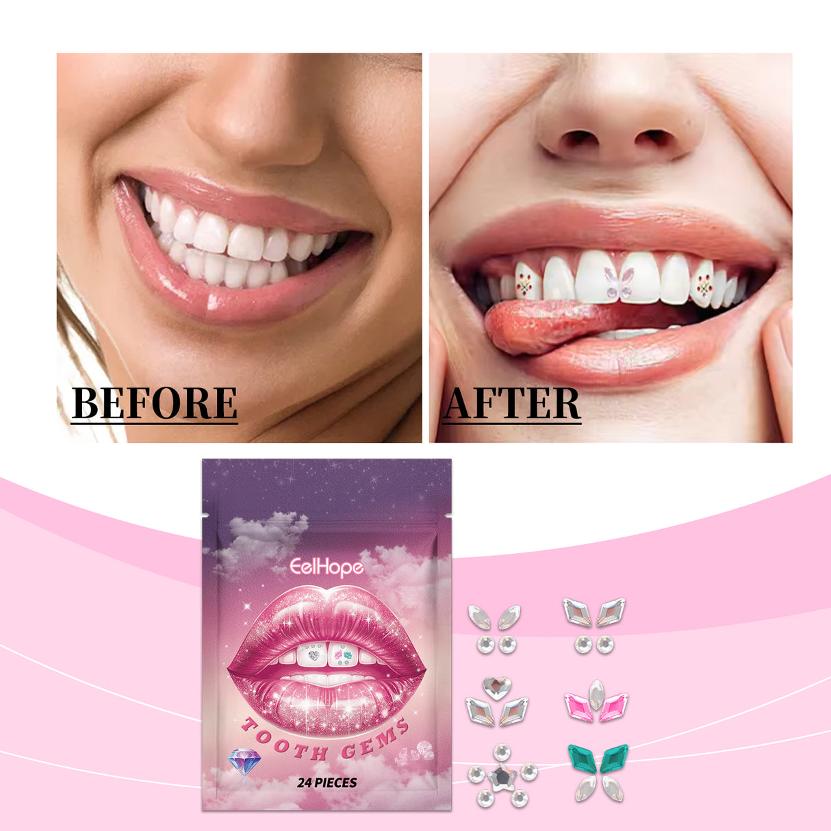 Crystal Dental Drill To Brighten Your Smile For A Long Time With Easy Use Of The Suitable Tooth Type Adhesive - V.I.P Digital Presence