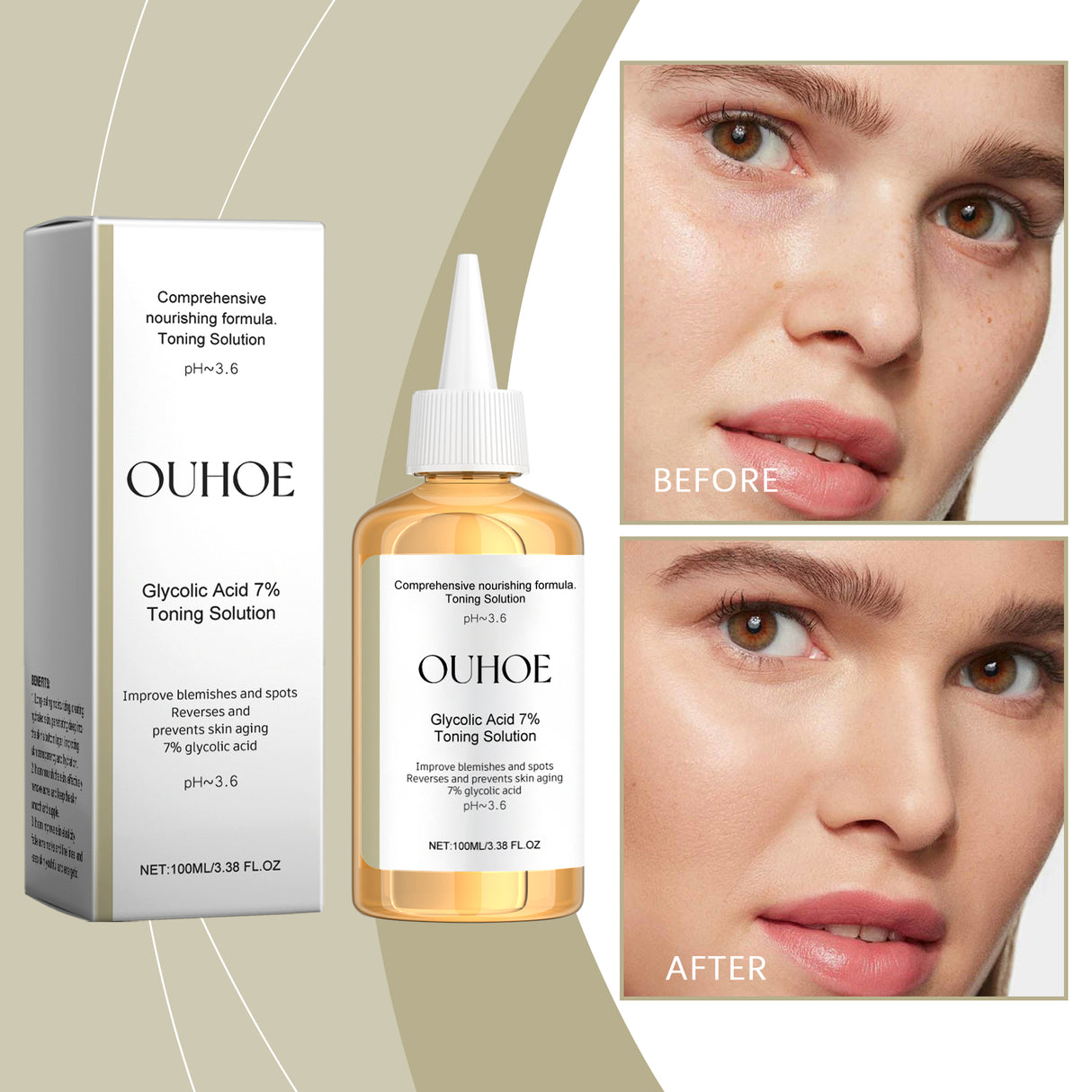Glycolic Acid 7% Moisturizing Toner, Remove Acne, Improve Skin Condition And Rejuvenate Skin Toner Essence - V.I.P Digital Presence