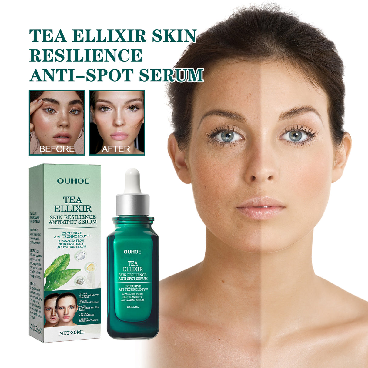Brightening Blemish Essence, Lightening Melasma Blemish Hydrating And Brightening Skin Essence - V.I.P Digital Presence