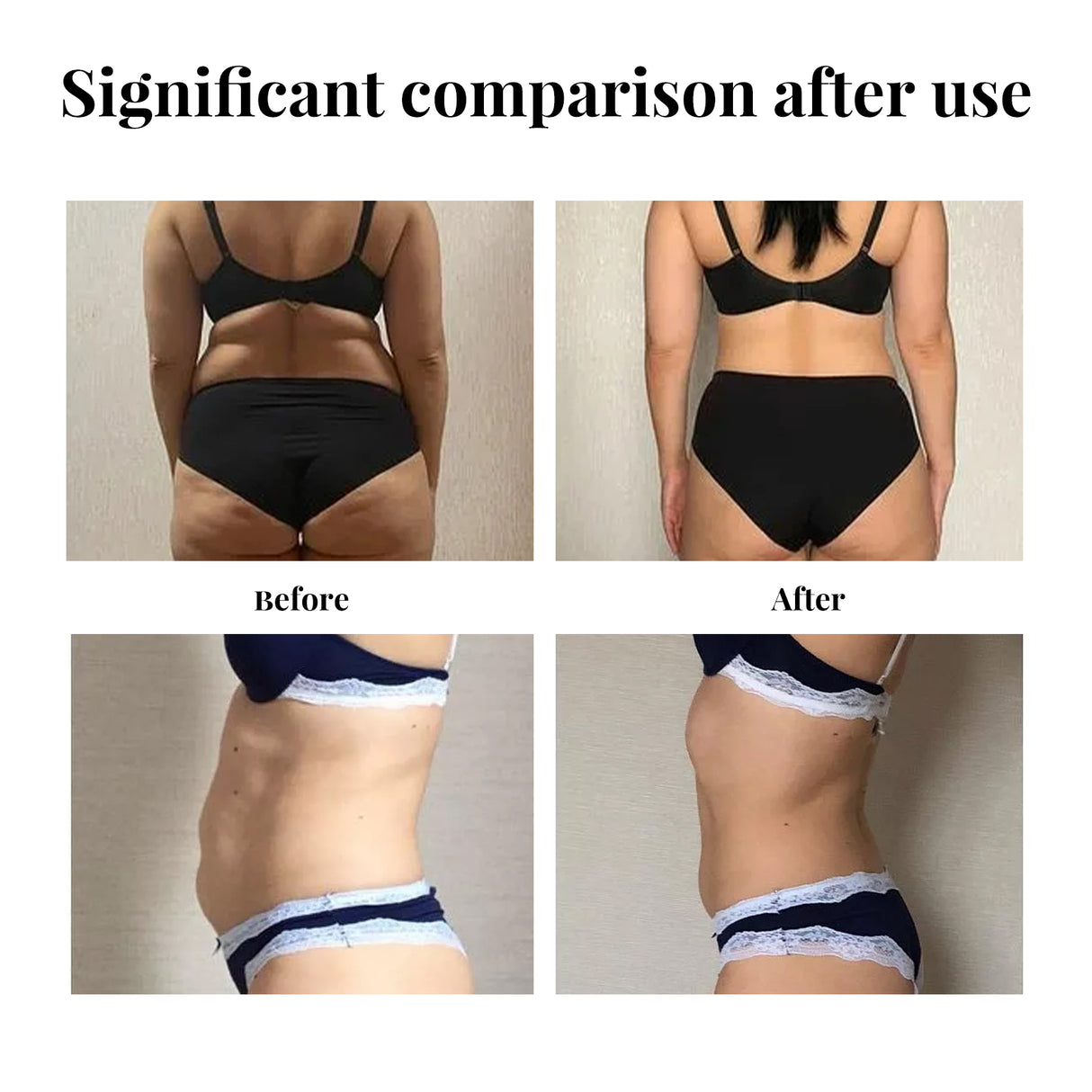 Belly Lift Tape, Lifts Loose Skin Tighten Shape Slim Belly Button Tape - V.I.P Digital Presence