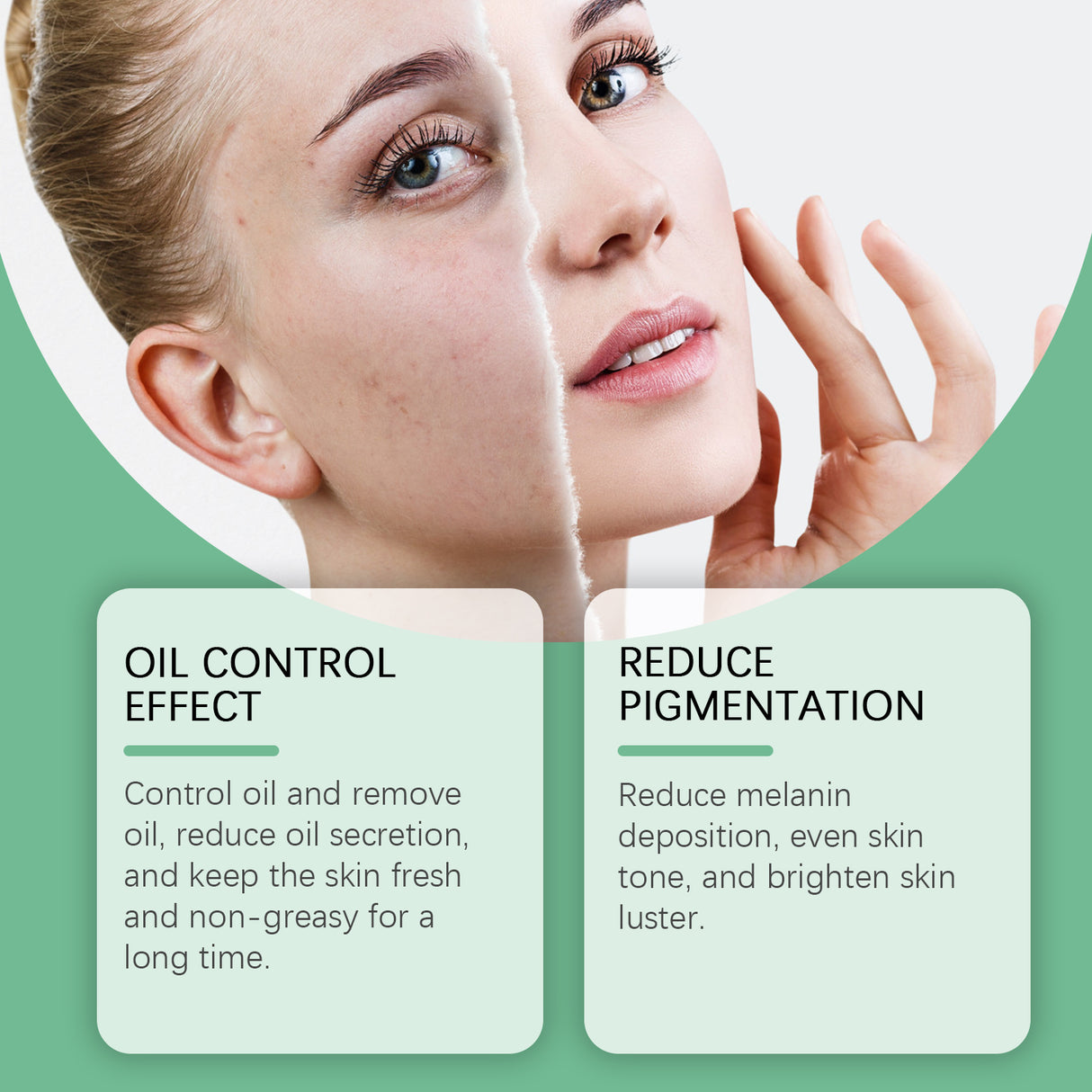 Crema hidratante reparadora con ácido azelaico, control de grasa facial, suave y refrescante.