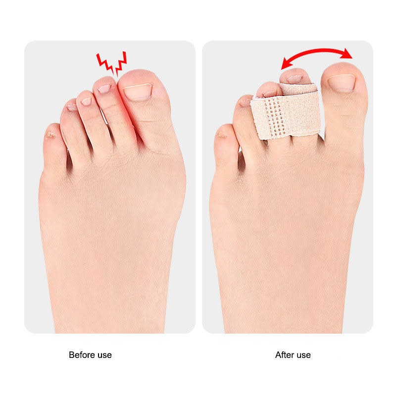 Toe overlap, thumb eversion, day and night use of male and female finger separation device - V.I.P Digital Presence