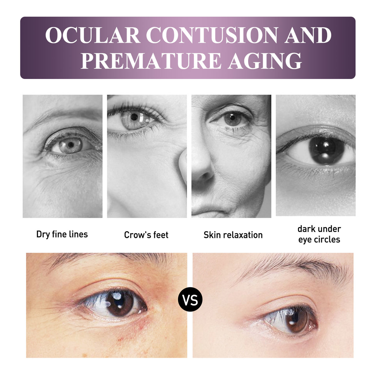 Electric Anti-Wrinkle Eye Cream Lifts, Strengthens, Moisturizes And Reduces Fine Lines, Bags And Dark Circles Under Eye Care - V.I.P Digital Presence