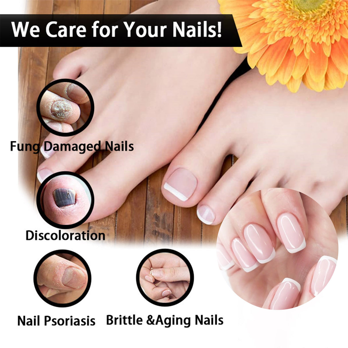 Nail Repair Solution Thickening Brightening Nails Removing Gray Nails Dead Skin Repair Nourishing Nail Care Solution - V.I.P Digital Presence