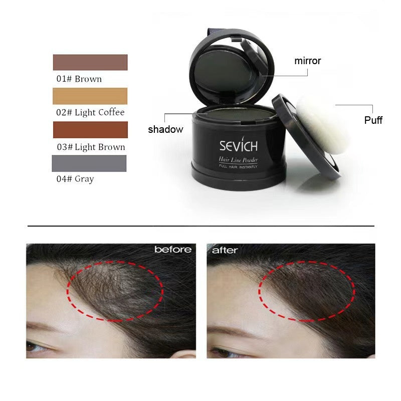 Forehead Sparse Hair Concealment and Contouring Hairline Filler - V.I.P Digital Presence