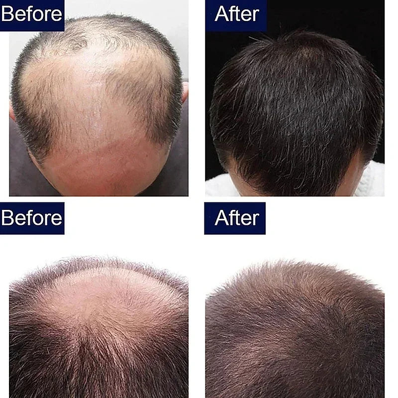 7 Day Fast Hair Growth Oil Ginger Growth Hair Treatment Anti Hair Loss Men Women Scalp Treatment Serum Products Beauty Product - V.I.P Digital Presence