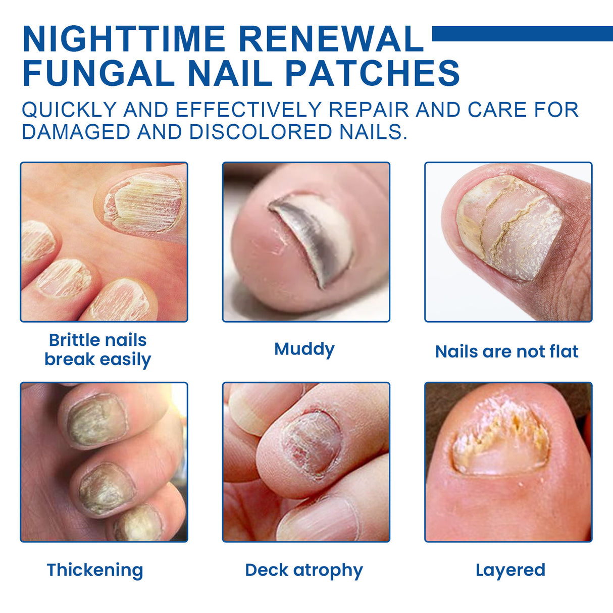 Nighttime Renewal Fungal Nail Patches, Repair And Thickening Gray Nail Insert Soft Nail Care Patch - V.I.P Digital Presence