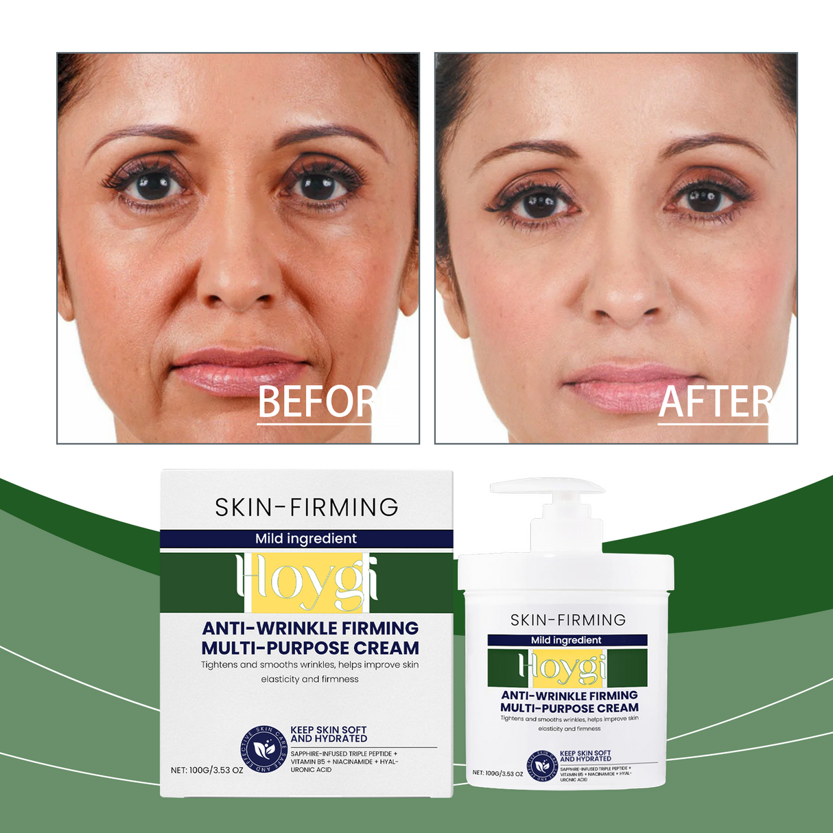 Moisturizing Cream Nourishes The Face, Hydrates The Skin, Moisturizes The Skin, And Moisturizes The Skin - V.I.P Digital Presence