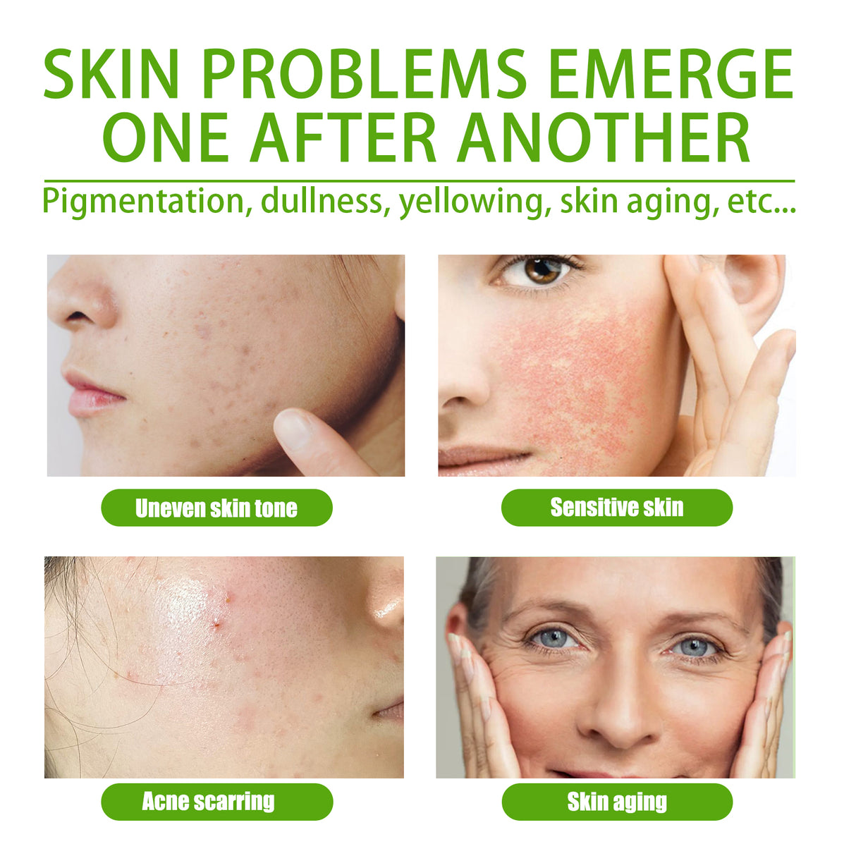 Crema facial en gel que aclara manchas y líneas finas, repara enrojecimiento y poros delicados, crema facial hidratante suave.