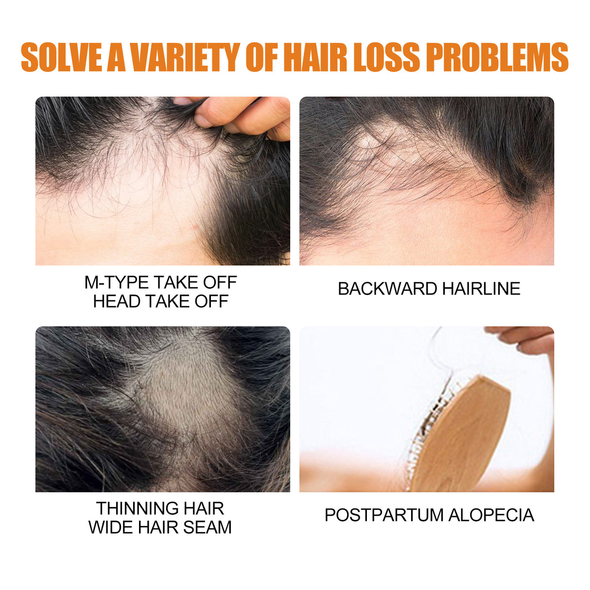 Hair Growth Spray, Men Hair And Beard Thickening Strengthening Anti-loss Care Solution - V.I.P Digital Presence
