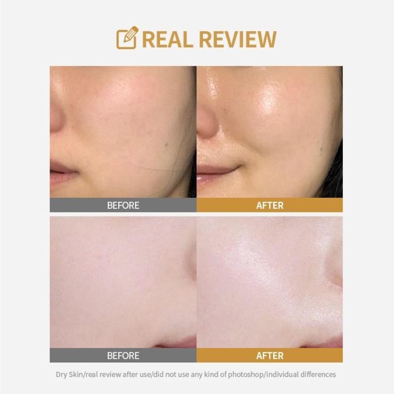Mascarilla facial rehidratante (5 piezas)