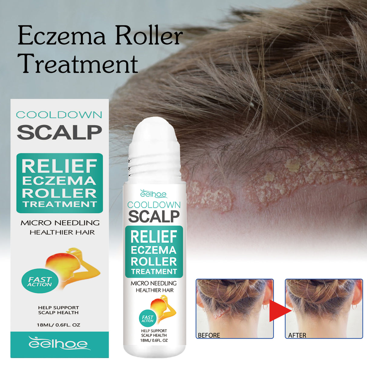Scalp Care Ball, Repair Skin Moss Scalp Moss Deep Clean And Moisturizing Scalp Care Ball - V.I.P Digital Presence