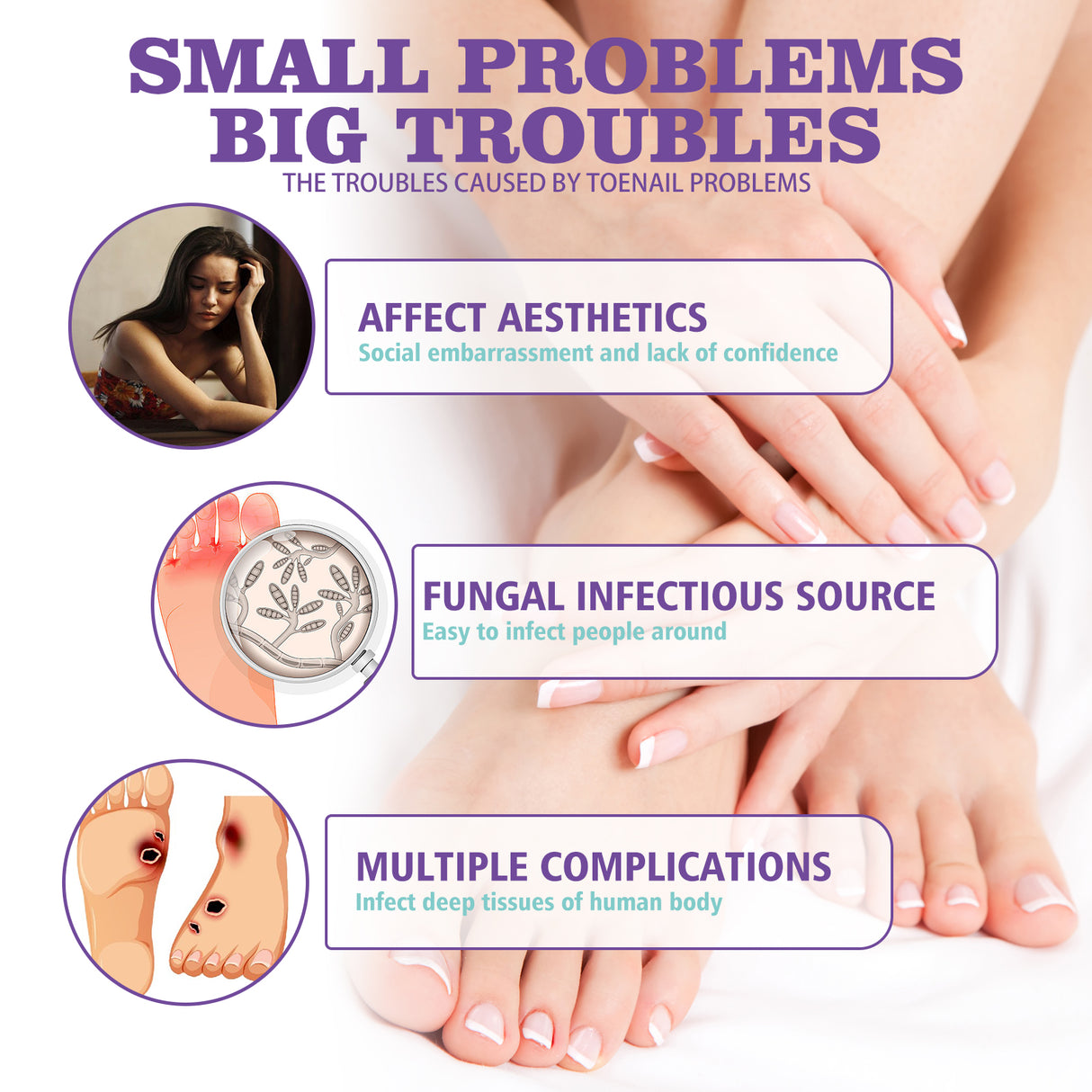 Gray Nail Care Spray Soft Ingrown Nails, Ingrown Nails, Yellowing And Thickening Cleaning Care