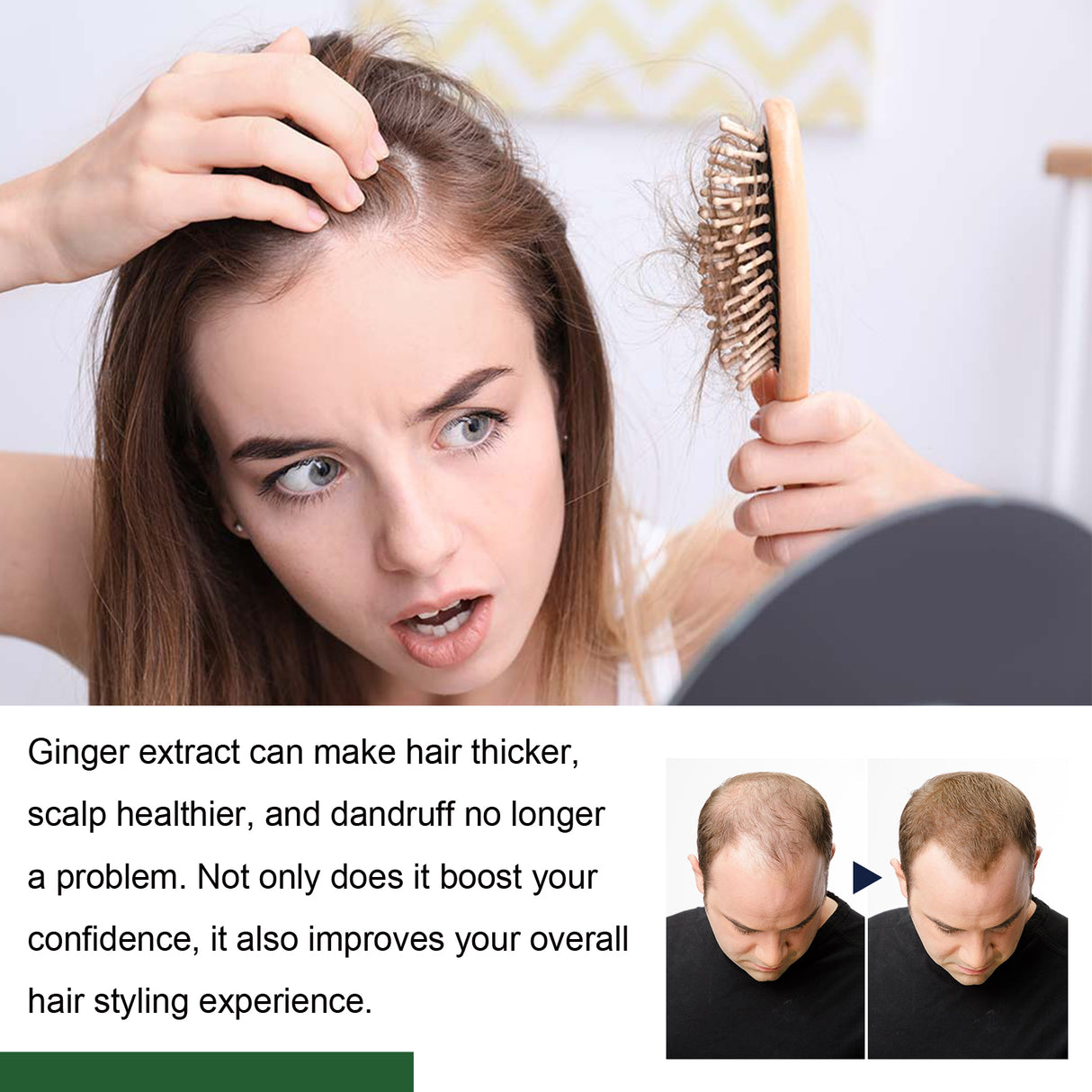 Ginger Hair Care Ball Scalp Care Nourishes Soft, Fluffy, Glossy Hair And Strengthens Hair - V.I.P Digital Presence