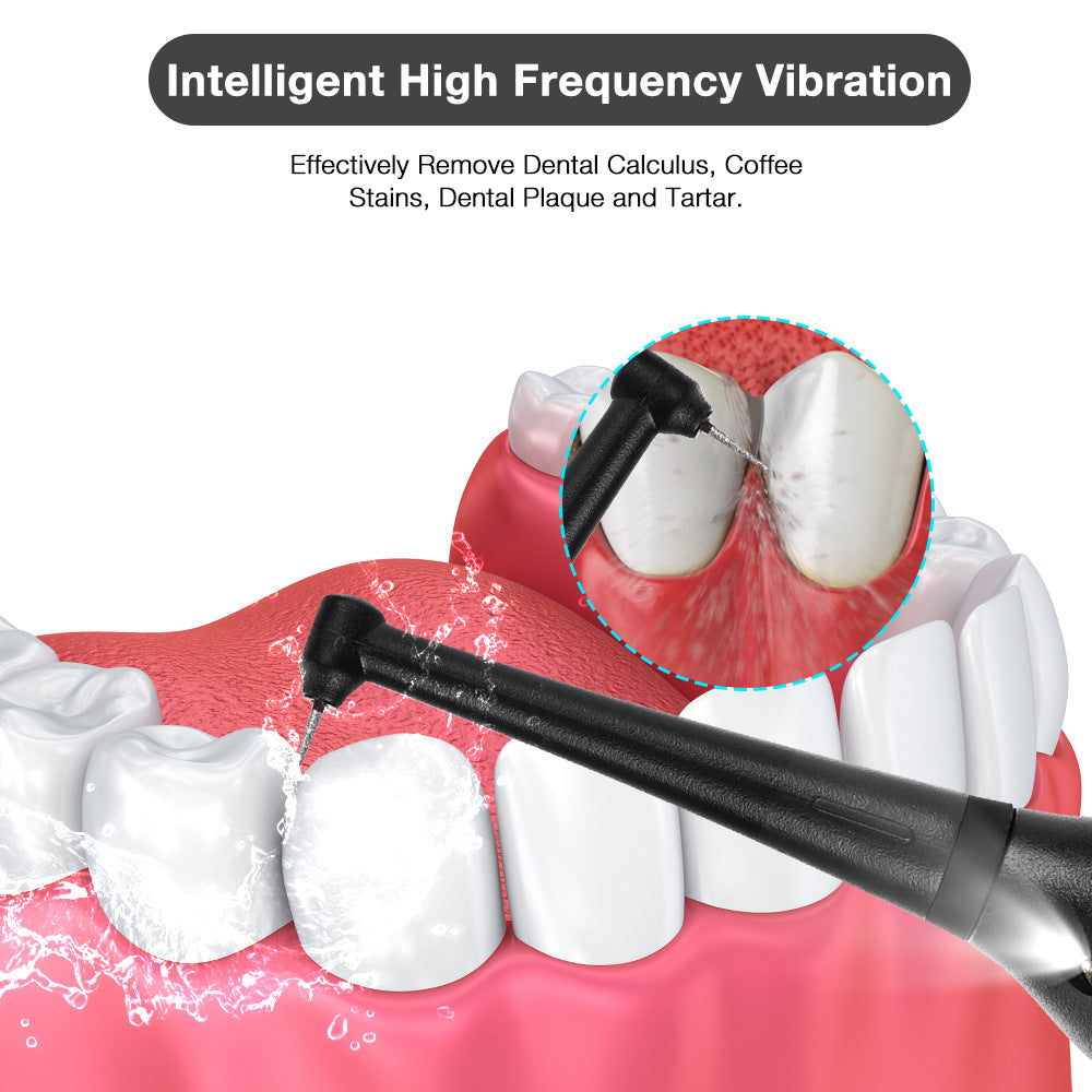Portable Electric Tooth Scaler Dental Care Tool Adult Beauty Tooth Scaler To Remove Calculus - V.I.P Digital Presence