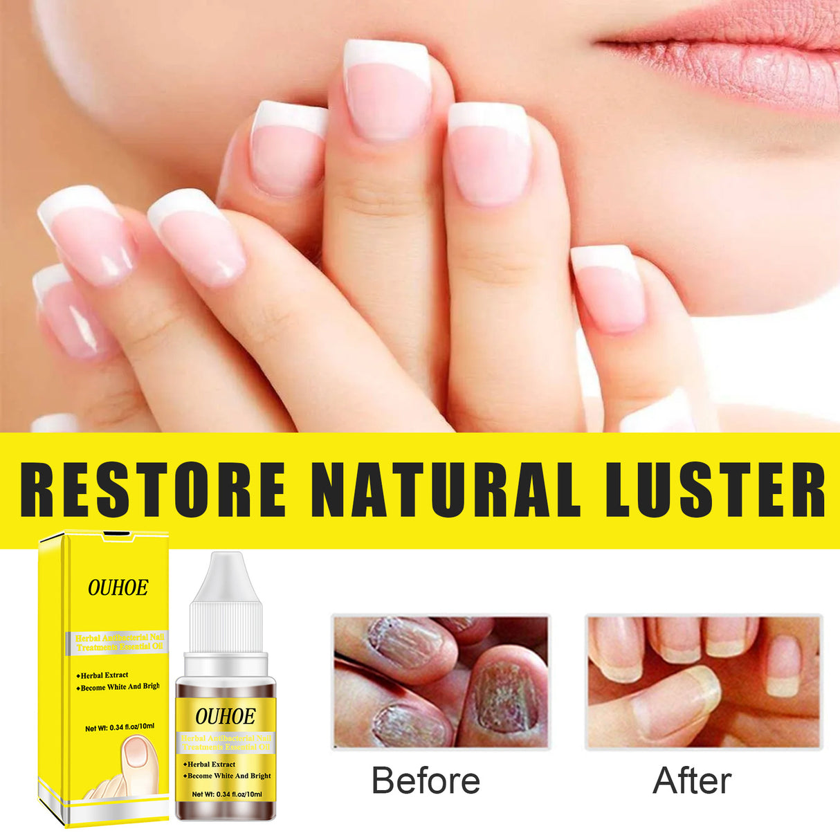 Herbal Antibacterial Nail Treatments Essential Oil, Grey Nail Care Essential Oil Brightening Nail Polish Clean Manicure Foot Care Solution - V.I.P Digital Presence