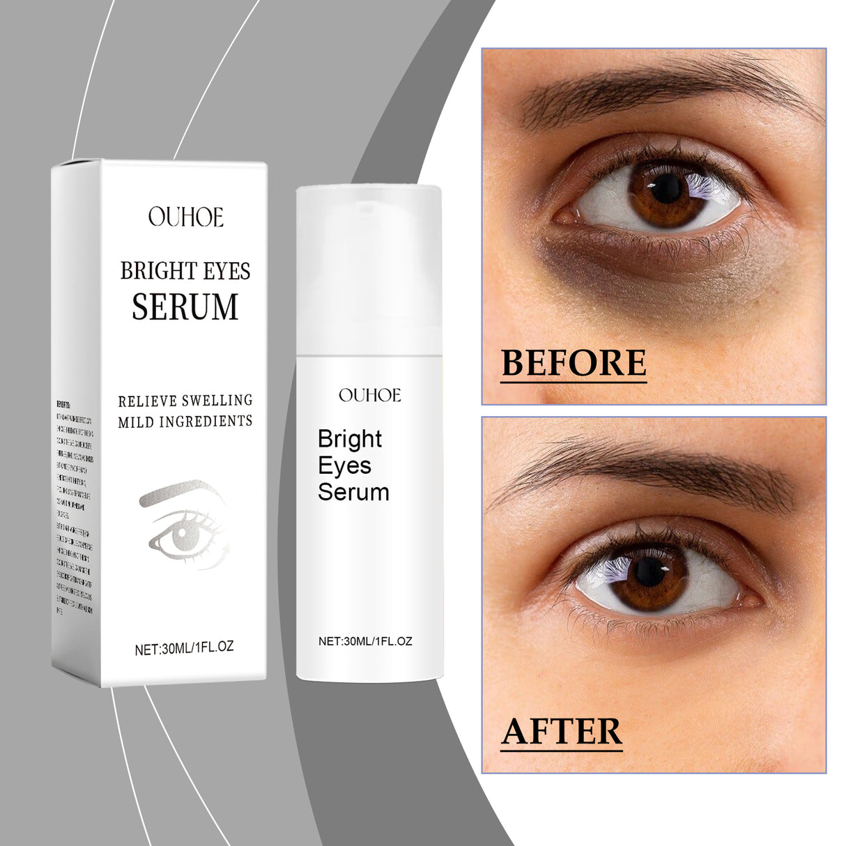 Eye Essence Moisturizes And Tightenes The Skin Around The Eyes, Lightening The Fine Lines And Bags Under The Eyes - V.I.P Digital Presence