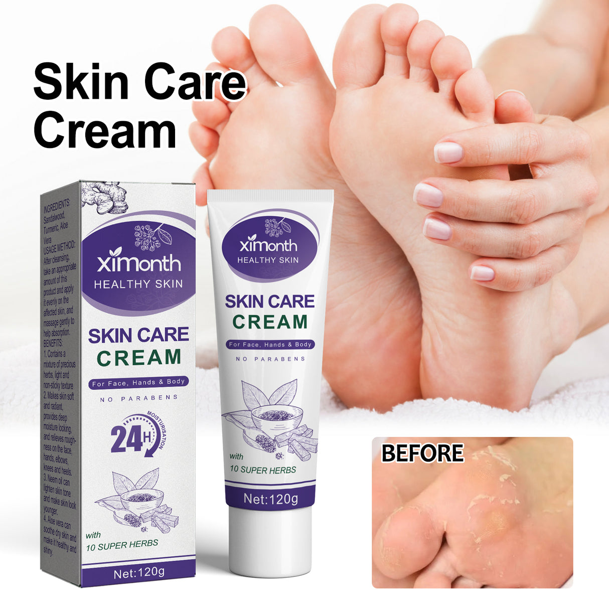 Skin Care Cream, Autumn And Winter Skin Anti-Crack Peeling Exfoliating Moisturizing Soft Moisturizing Body Cream - V.I.P Digital Presence