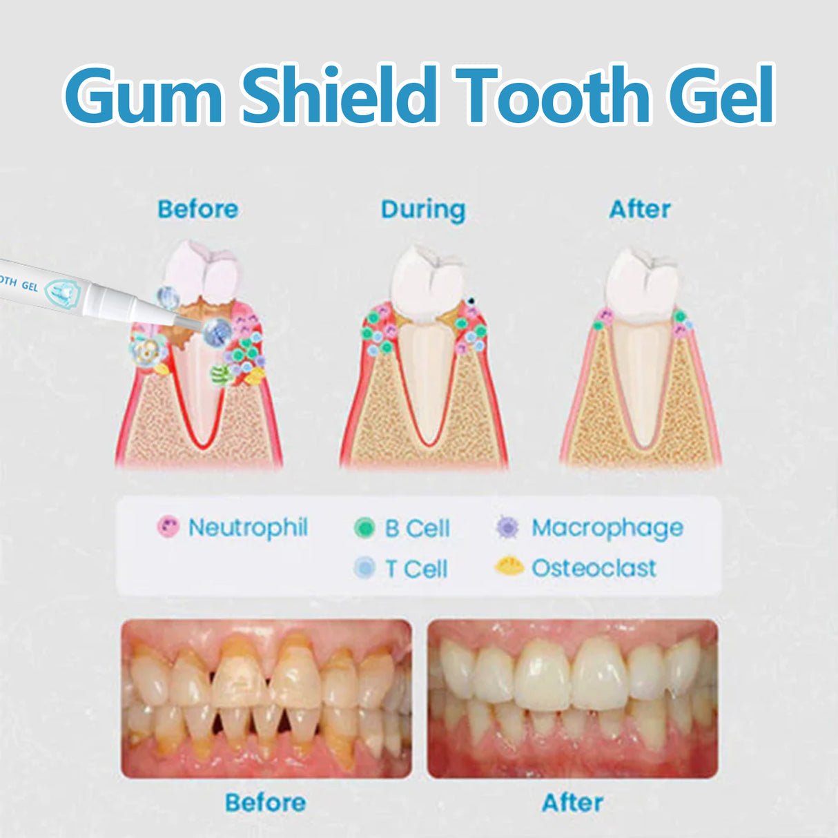 Gingival Oral Gel Pen, Clean Tooth Stains, Care For Gums, White Teeth, Oral Care Gel Pen - V.I.P Digital Presence
