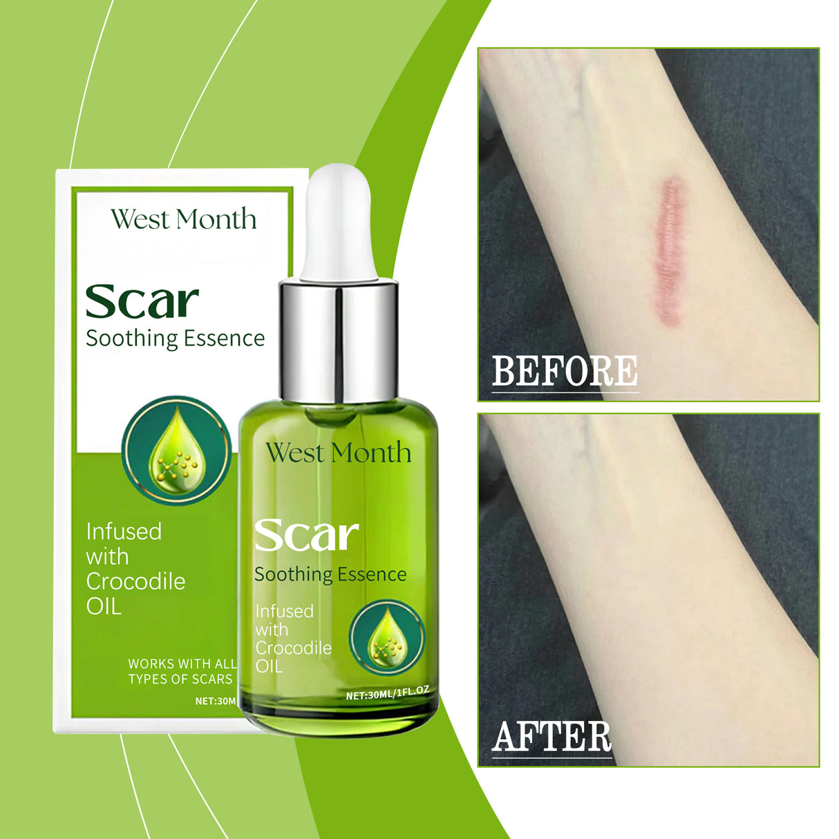 Skin Repair Essence, Body Skin Moisturizing, Firming And Rejuvenating Care Essence - V.I.P Digital Presence