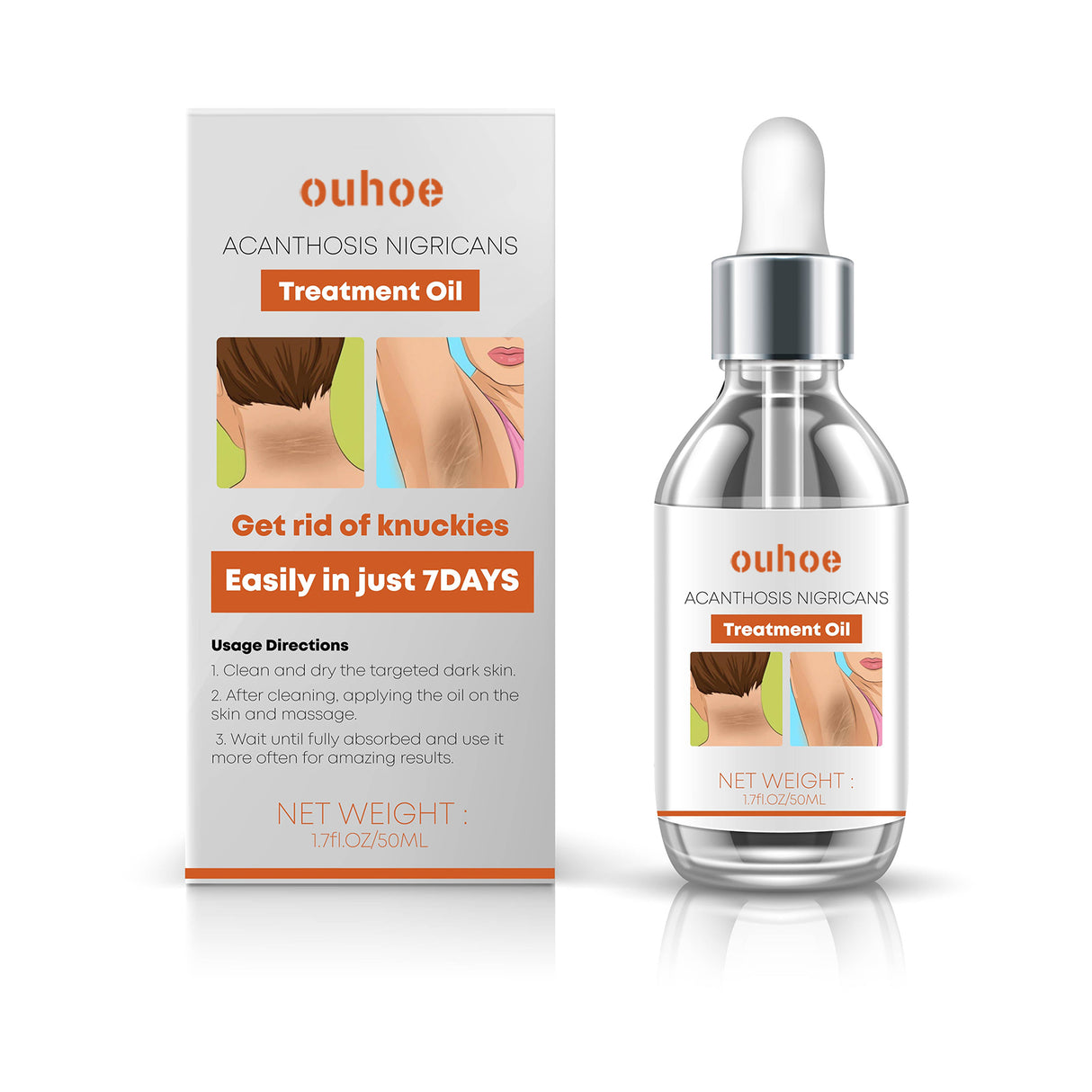 Black Wattle Essential Oil, Repair Underarm Joint Black Whitening Skin Light Spots Skin Beauty Essence Oil - V.I.P Digital Presence
