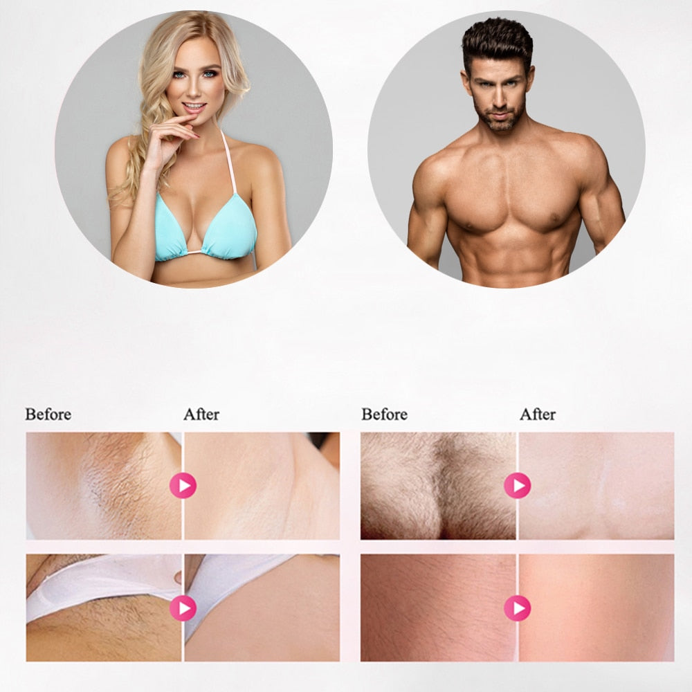 LippyTime IPL Laser Hair Removal - V.I.P Digital Presence