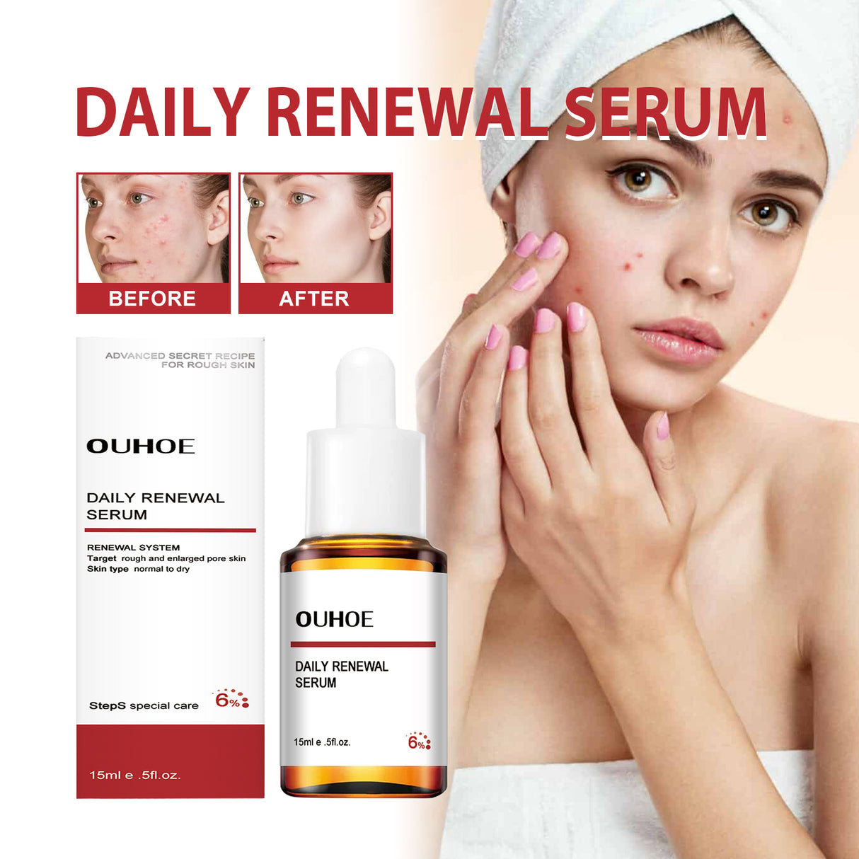 Mandelic Acid Daily Update Essence, Acne-Removing And Acne-Closing Repair Brightening Fruit Acid Essence - V.I.P Digital Presence
