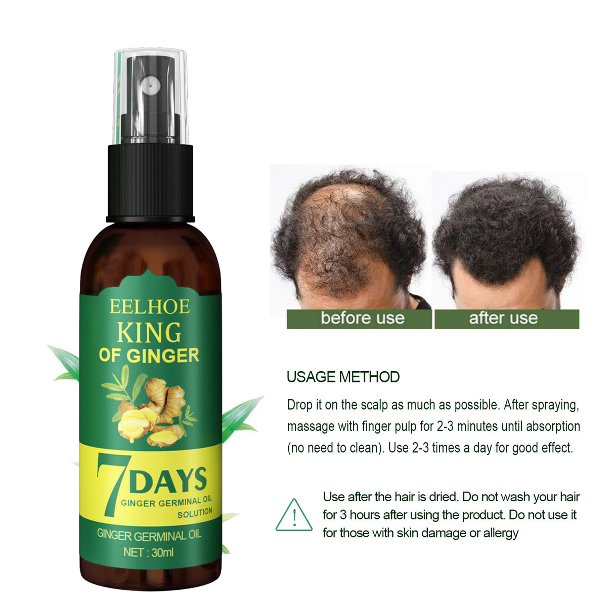 EEL Ginger Hair Spray, Strengthens Hair, Massages Scalp And Restores Hair - V.I.P Digital Presence