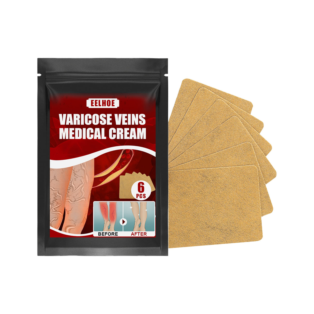 Aricose Veins Medical Cream, Relieve Leg Swelling Earthworm Leg Vein Massage To Relieve Pain - V.I.P Digital Presence