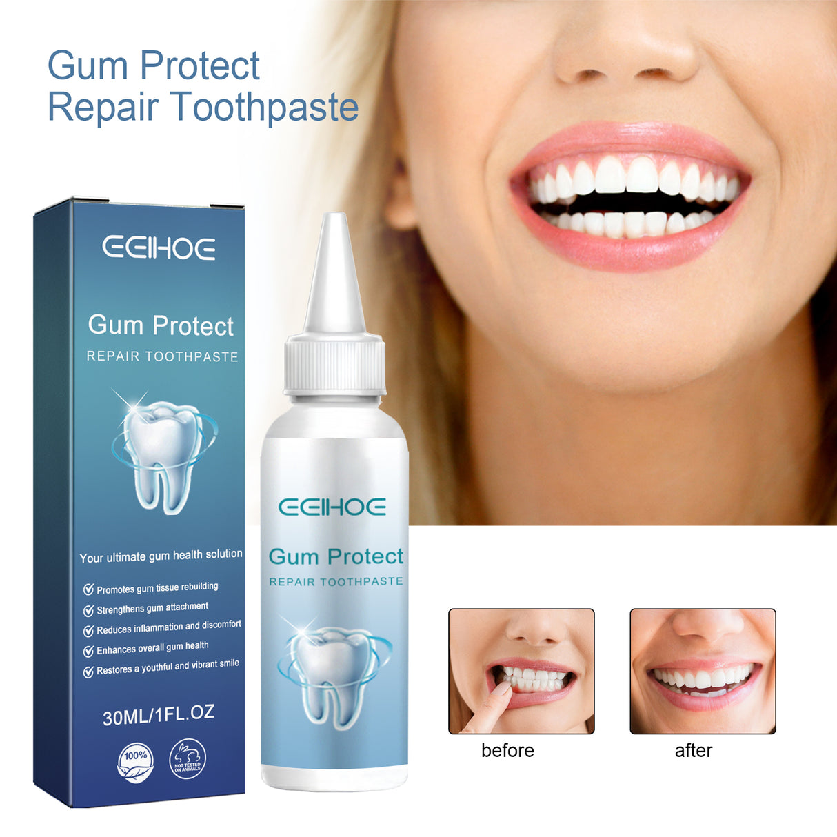 Dental Care Toothpaste Cleans The Mouth, Removes Tartar Stains, Yellow Teeth, Brightening Teeth, Care For Teeth - V.I.P Digital Presence