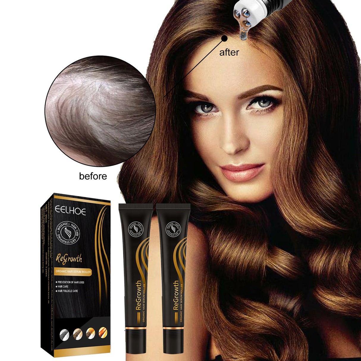 EELHOE Ball Bearing Dense Hair Essential Oil Thick Sparse Hair Bead Massage Scalp Care Fluid To Prevent The Loss Of Essential Oil - V.I.P Digital Presence