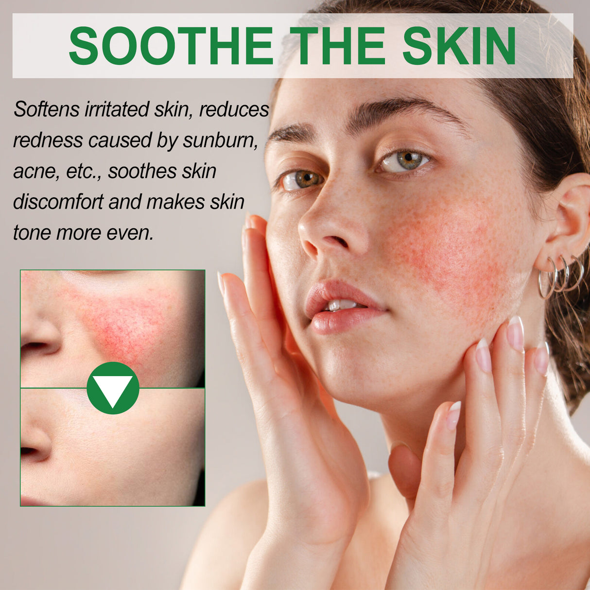 Color Correction Treatment Cream, Lighten Spots After Sun Repair Moisturizing Skin Beauty Cream - V.I.P Digital Presence