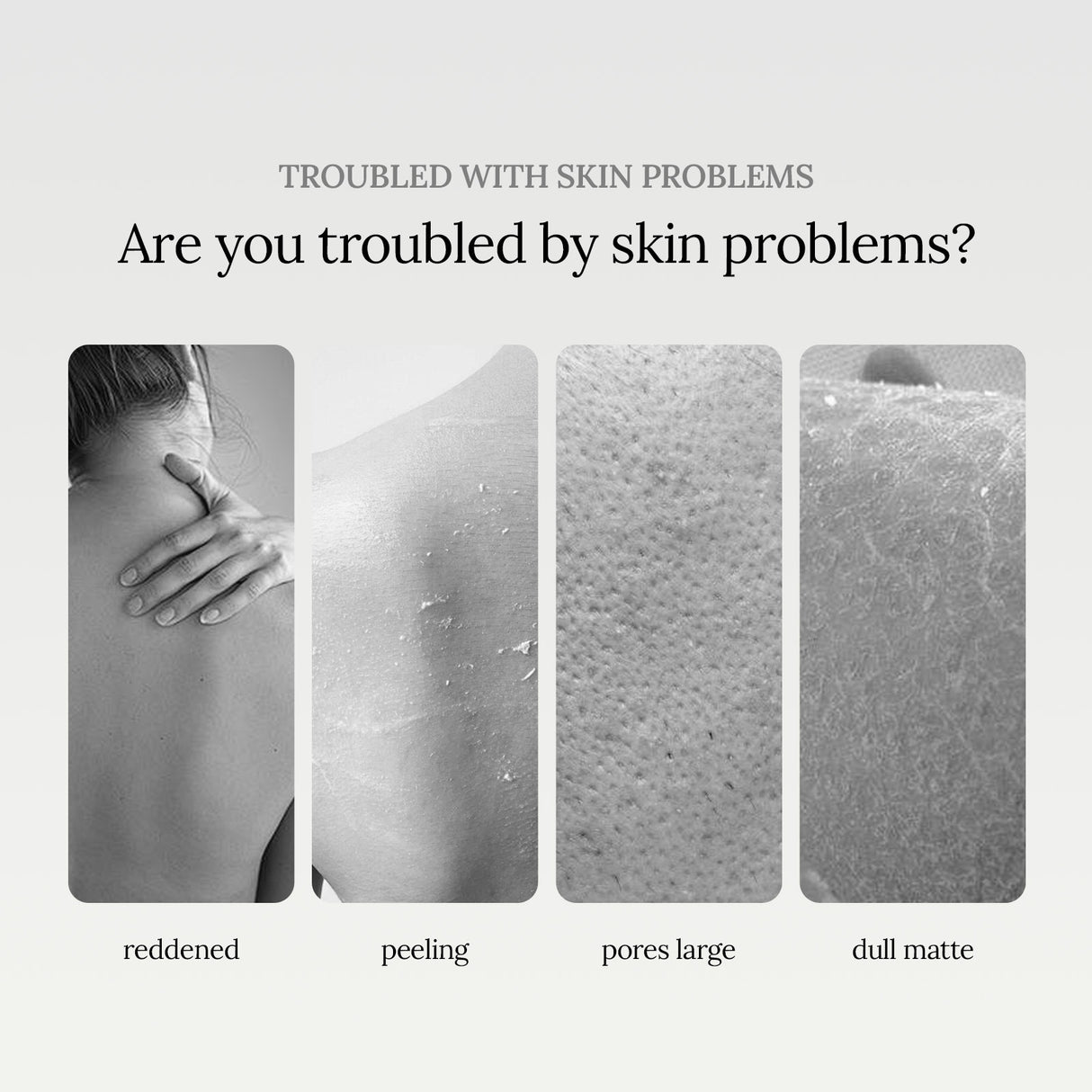 Niacinamide Scented Shower Gel, Body Cleans Corneous Brighten Skin Tone Delicate Pore Moisturize Repair - V.I.P Digital Presence