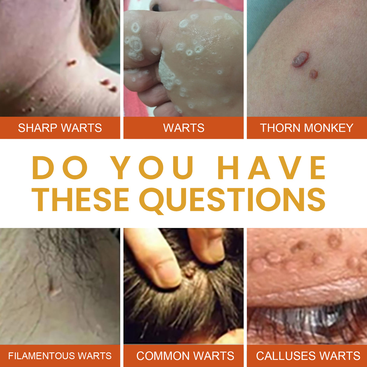 Anti-wart Essence, Anti Warts Fade Moles Corns Smoothing Skin Care Essence - V.I.P Digital Presence