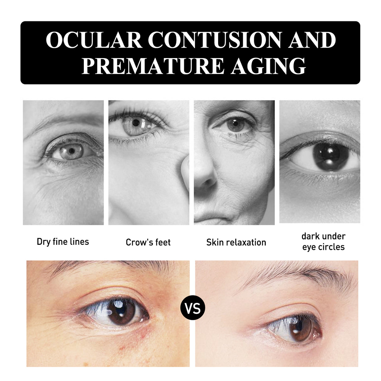 Eye Firming And Lifting Cream Moisturizes And Relieves Dry Lines, Hydrates And Improves Fine Lines - V.I.P Digital Presence