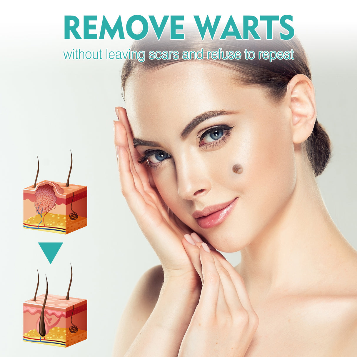 Gram Verruca Pen, Deep Cleaning Gram Verruca Remove Corns Meat Granules Repair Smooth Skin Anti-Verruca Liquid