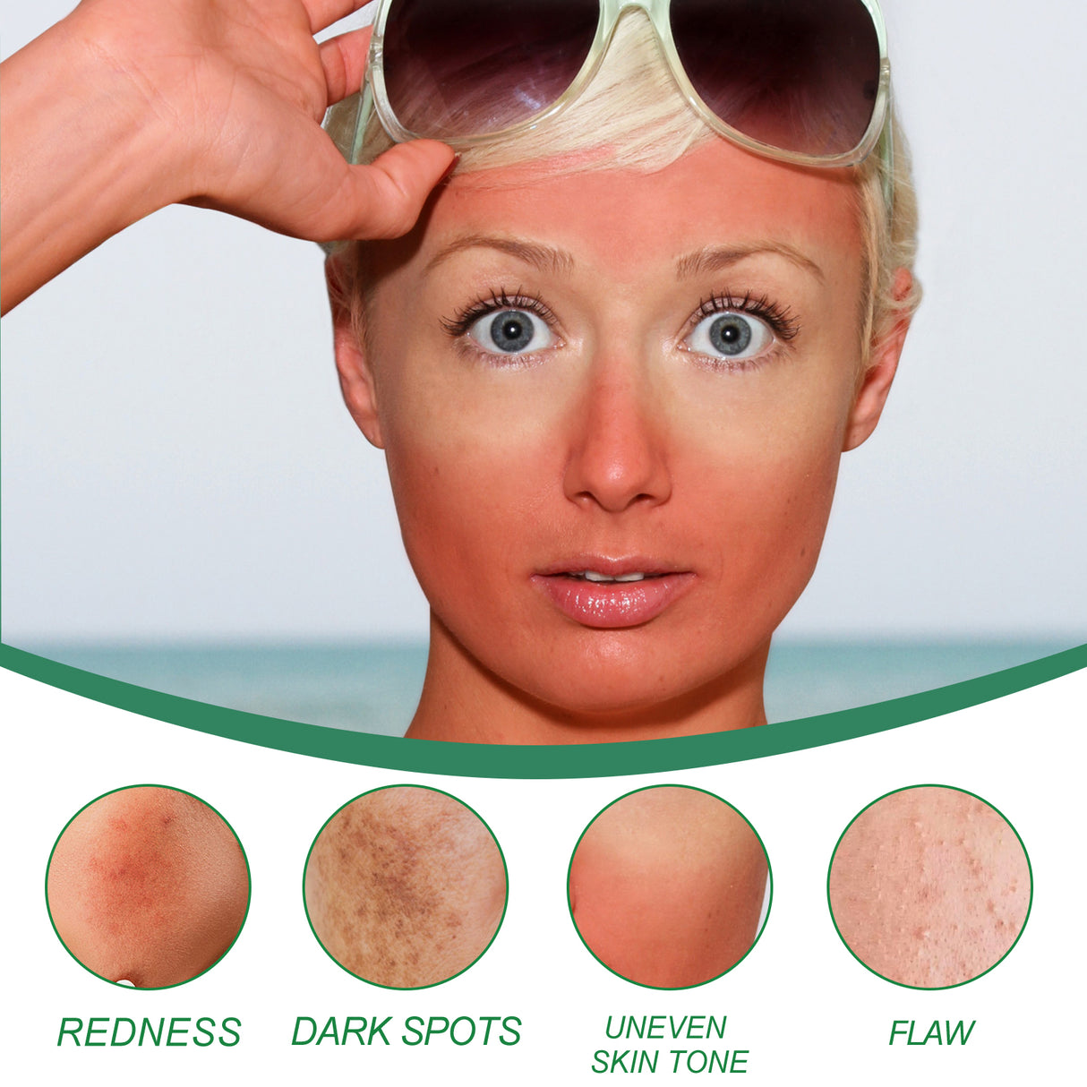 Color Correction Treatment Cream, Lighten Spots After Sun Repair Moisturizing Skin Beauty Cream - V.I.P Digital Presence