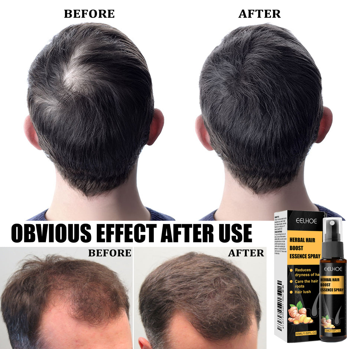Herbal Hair Essence Spray,Prevent Falling Hair And Scalp Moisturizing And Nourishing Solution - V.I.P Digital Presence